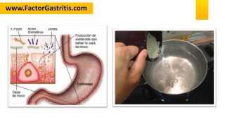 DIETA PARA HELICOBACTER PYLORI [upl. by Labana]