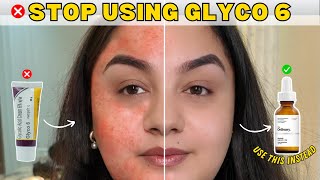 Is Glycolic Acid Right For You SAFE Alternatives to Try Instead [upl. by Etnuhs]