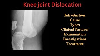 Knee joint dislocation Causes Types Clinical features Examination Investigations amp Treatment [upl. by Nodaj]