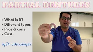 Partial Dentures Pros amp Cons  Cost  Different Types [upl. by Enirac]