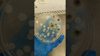 Fungus on Potato Dextrose agar [upl. by Medwin229]