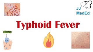 Typhoid Fever Pathogenesis vectors bacteria Symptoms Diagnosis Treatment Vaccine [upl. by Gerardo997]