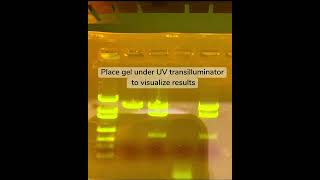 Gel Electrophoresis [upl. by Naened]