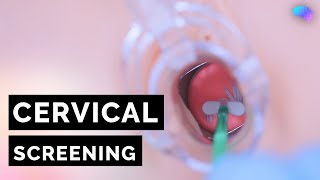 Cervical Screening Smear  HPV  OSCE Guide  UKMLA  CPSA [upl. by Clo331]