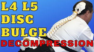 L4 L5 Disc Bulge Decompression Exercises  Best Exercise For L4 L5 Disc Bulge  Dr Walter Salubro [upl. by Ydnerb224]