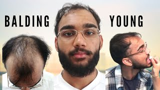 BALDING Before 20  My Journey Overcoming Balding Insecurity [upl. by Ecnarolf]