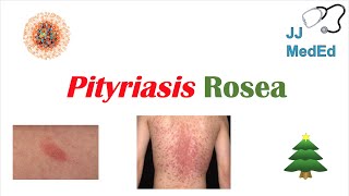 Introduction to Pityriasis Rosea  Possible Causes Symptoms and Treatment [upl. by Zetnas]