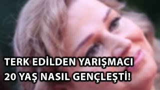 Eşi Tarafından Aldatılan Yarışmacı Model 20 Yaş Nasıl Gençleşti [upl. by Bartram]