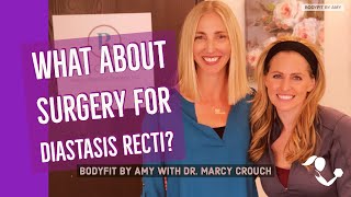 What about surgery for diastasis recti What is it and who should have it [upl. by Betthezel171]