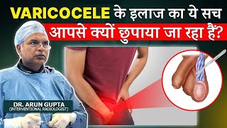 जानिए Varicocele के सभी Surgical और NonSurgical Treatment Options in India [upl. by Elnar]