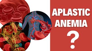 Aplastic anemia Aplastic anemia causes [upl. by Everrs]