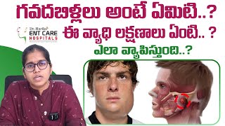 గవదబిళ్లలు అంటే ఏమిటి  Acute Parotitis or Mumps in Telugu  Dr Harika ENT Care Hospital [upl. by Alol847]