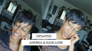 Anemia Hair Loss  Natural Hair Journey Update with Blood Builder Iron Pills and Floradix Iron [upl. by Gessner]