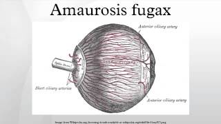 Amaurosis fugax [upl. by Isbella]