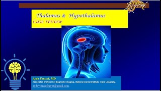 thalamus and hypothalamus case review [upl. by Fonsie]