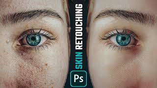 Clean Your Skin  Skin Retouching  Best Photoshop Tutorial [upl. by Eriuqs]