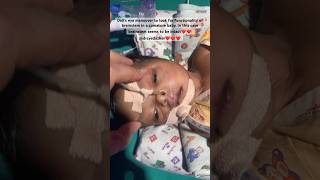 Baby in Coma viral cute mom doctor cartoon sick coma sad nicu twins health dad baby [upl. by Ailedua711]