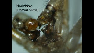 Cellar Spider Pholcidae  Dorsal View under Dissecting Microscope [upl. by Corenda]