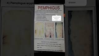 Pemphigus skin dermatology homoeopathy doctor [upl. by Petie]