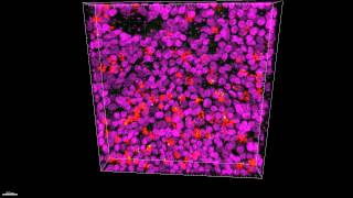 CX3CR1 Is Expressed in Differentiated Human Ciliated Airway Cells and CoLocalizes [upl. by Odnam]