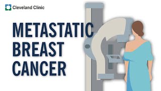 What Is Metastatic Breast Cancer [upl. by Uamak813]