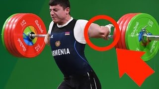 5 Most Painful Injuries At The Rio Olympics [upl. by Anaujd]