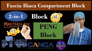 RA Masterclass Ultrasound Scanning Session  PENG Block  FICB  2in1 Block  DrTuhinM [upl. by Suillenroc624]