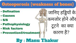 OsteoporosiscausessignampSymptoms of Osteoporosis Silent disease Osteoporosis full Details in hindi [upl. by Wyon]