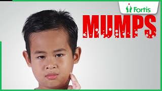 Learn about Mumps Symptoms Causes and Treatments with Dr Neetu Talwar [upl. by Coward]