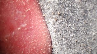 Pore Strips removal close up Blackheads removal [upl. by Rodney67]