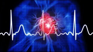 SVT AF VT VF Aritmiler EKG 2 [upl. by Henn145]