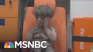 Images Of Injured Syrian Boy Draws Attention  MSNBC [upl. by Hayidan672]