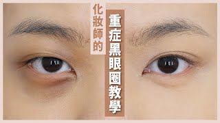 🍄嚴重重症黑眼圈教學🍄 👁️👁️ 專業化妝師秘技 [upl. by Anav]