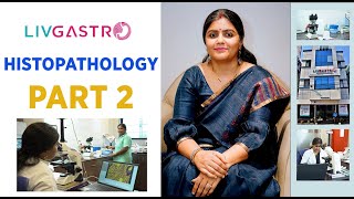 DISCUSSION ON HISTOPATHOLOGY PART 2  SYMPTOMS  TREATMENT  LIFESTYLE  DRANSHITA RAI [upl. by Eryn345]