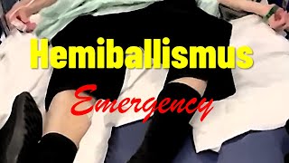 Hemiballismus Emergency [upl. by Ursula]