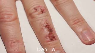 Wound Healing Time Lapse [upl. by Enomor]