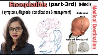 Encephalitis part3  symptoms  diagnosis  treatment in hindi  medical Destination [upl. by Alyt]