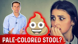 What Does PaleColored Poop Mean – DrBerg [upl. by Carney]