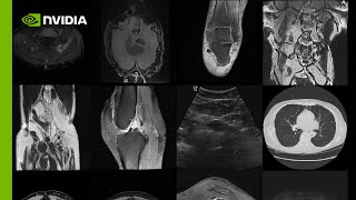 Create Infinite Medical Imaging Data with Generative AI [upl. by Sucy]