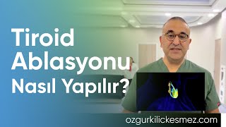 Tiroid ablasyonu nasıl yapılır [upl. by Nemzaj]