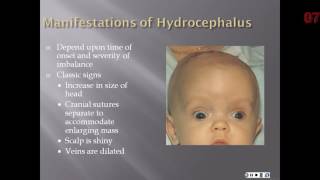 Chapter 14  The NB with Perinatal injury or Congenital Malformation [upl. by Marrissa]