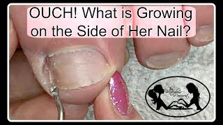 Pedicure Tutorial What Mimics Ingrown Toenail Pain Pro Tools Available on My Online Store ✔️ [upl. by Leachim853]