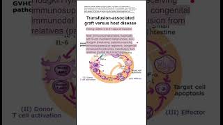 Transfusionassociated graft versus host disease [upl. by Attelocin467]