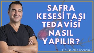 Safra Kesesi taşı nedir Belirtileri nelerdir Tedavisi nasıl yapılır [upl. by Heidie]