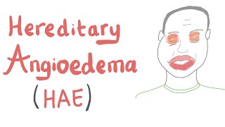 Hereditary Angioedema HAE [upl. by Bekelja343]