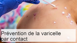 Peuton attraper la varicelle en côtoyant un enfant malade [upl. by Mathis587]