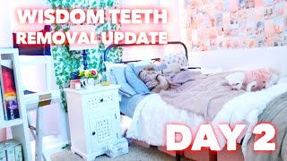 WISDOM TEETH REMOVAL UPDATE DAY 2 SWOLLEN  Family 5 Vlogs [upl. by Liederman667]