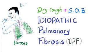 Idiopathic Pulmonary Fibrosis  Restrictive Lung Disease  Pulmonology [upl. by Garzon]