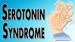 Managing Serotonin Syndrome [upl. by Nisaj230]