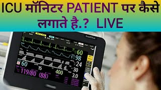 ICU monitor  how to use vital sign monitor  Hindi  ADVANCE TECHNOLOGY [upl. by Asi976]